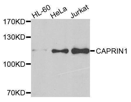 Anti-CAPRIN1 Antibody