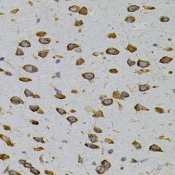 Anti-CAPRIN1 Antibody