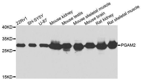 Anti-PGAM2 Antibody