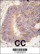 Anti-PDE8A (Center) (L572) Antibody