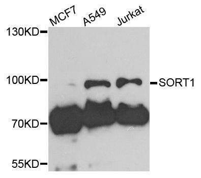 Anti-SORT1 Antibody
