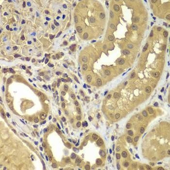 Anti-SORT1 Antibody
