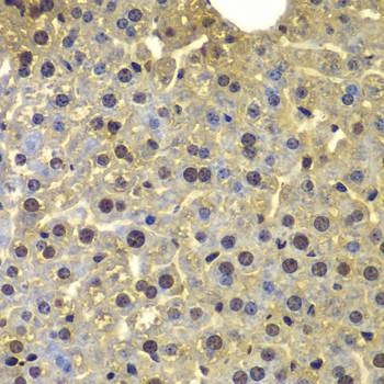 Anti-SORT1 Antibody