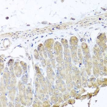 Anti-IRS2 Antibody