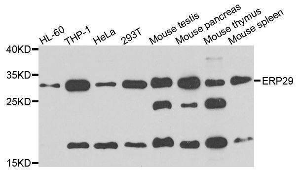 Anti-ERP29 Antibody