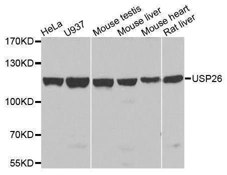 Anti-USP26 Antibody