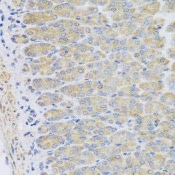 Anti-EFHC1 Antibody