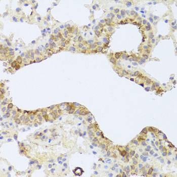Anti-PDK3 Antibody