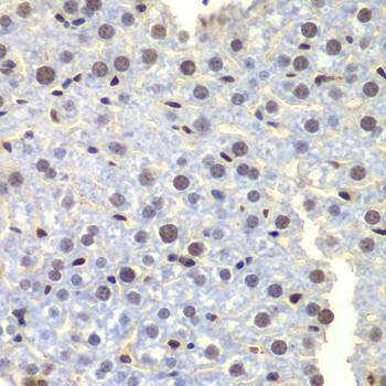 Anti-LHX4 Antibody