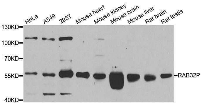 Anti-RAB3IP Antibody