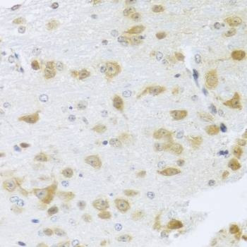 Anti-Gm13125 Antibody