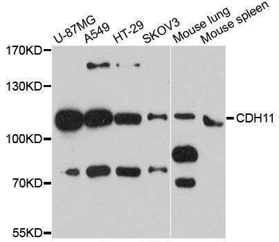 Anti-CDH11 Antibody