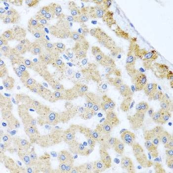 Anti-CETN3 Antibody