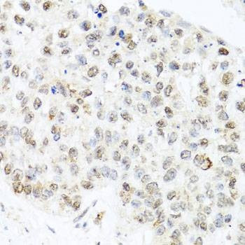 Anti-CETN3 Antibody