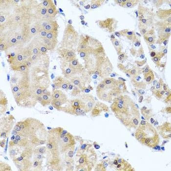 Anti-CETN3 Antibody