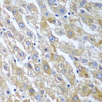 Anti-SGSH Antibody