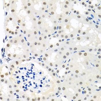 Anti-THOC1 Antibody