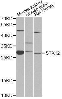 Anti-STX12 Antibody