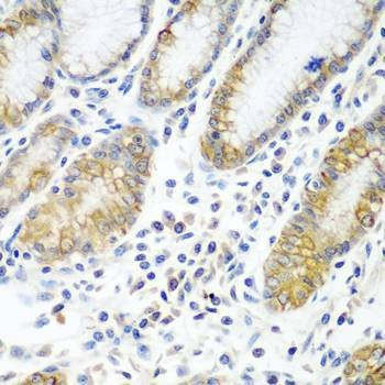 Anti-ATAD3A Antibody