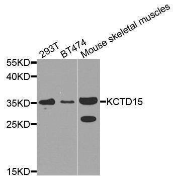Anti-KCTD15 Antibody