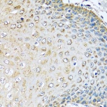 Anti-KCTD15 Antibody