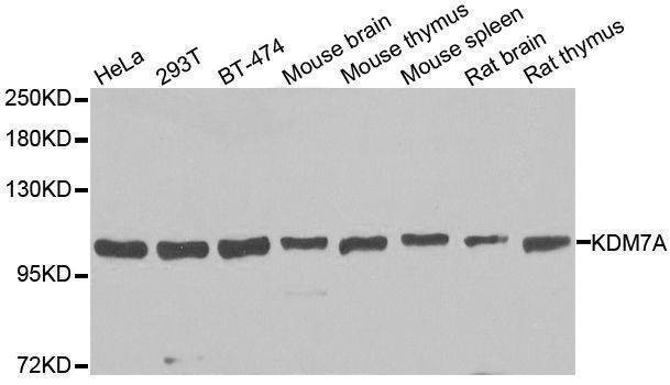 Anti-KDM7A Antibody