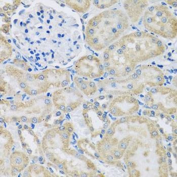 Anti-DCP2 Antibody