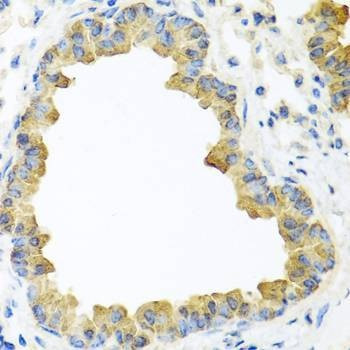 Anti-WNT5B Antibody