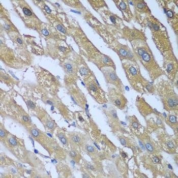 Anti-CAD Antibody