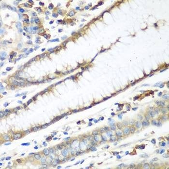Anti-CAD Antibody