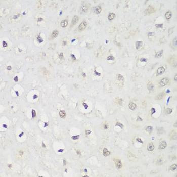 Anti-KPNA3 Antibody