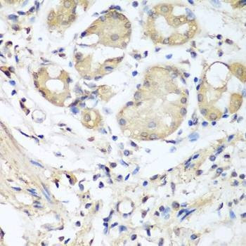 Anti-NID1 Antibody