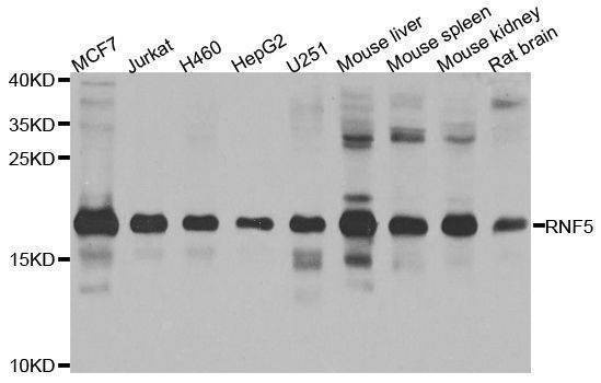 Anti-RNF5 Antibody