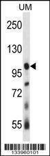 Anti-USP4 (N-term) Antibody