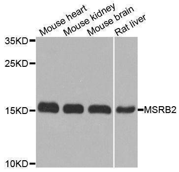 Anti-MSRB2 Antibody