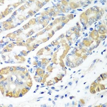 Anti-MSRB2 Antibody