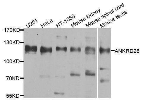 Anti-ANKRD28 Antibody