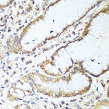 Anti-NUDT15 Antibody