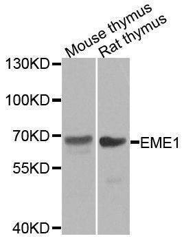 Anti-EME1 Antibody