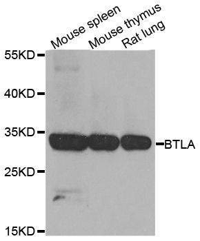 Anti-BTLA Antibody