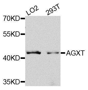 Anti-AGXT Antibody
