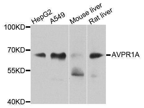 Anti-AVPR1A Antibody