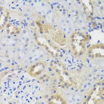 Anti-CTSC Antibody