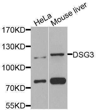 Anti-DSG3 Antibody