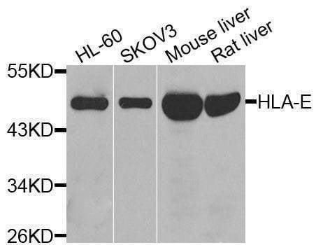 Anti-HLA-E Antibody