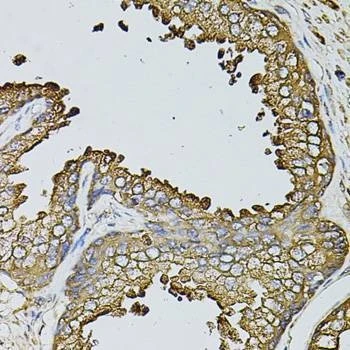 Anti-MYL1 Antibody