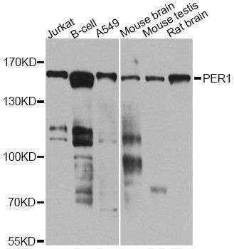 Anti-PER1 Antibody