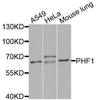 Anti-PHF1 Antibody