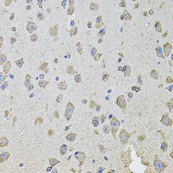 Anti-PHF1 Antibody