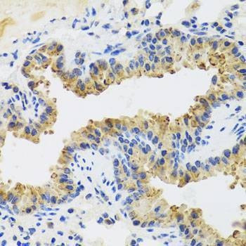 Anti-UVRAG Antibody